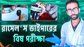 রাসেলস ভাইপারের বিষ মানুষের শরীরে কি ঘটায় সাপে কাটলে যেসব ভুল করা যাবে না Sabbir Ahmed [upl. by Trelu]