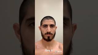 57 day time lapse bald to grown hair [upl. by Arick]