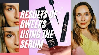 Review of UKLASH serum  Results of using it for 8 weeks [upl. by Rhyner104]