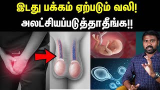 நரம்பு சுருண்டு போகும் அபாயம்  Causes symptoms amp cure for Varicocele explained in Tamil  Uyirmei [upl. by Glaudia247]