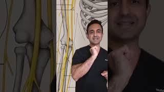 cubital tunnel syndrome cervicalradiculopathy [upl. by Ahrat]