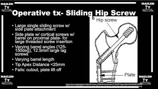 Dynamic Sliding Hip Screw Device Explained Clearly w Dr Sanders [upl. by Lorene]