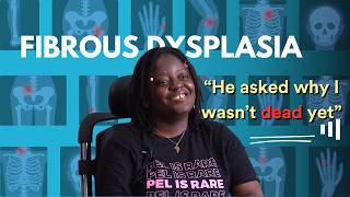 Living With Fibrous Dysplasia [upl. by Drauode]