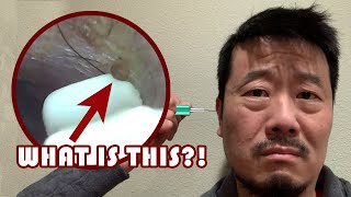 BEBIRD R1 Ear Wax Removal Tool IMPORTANT SETUP TIP and REVIEW [upl. by Anatolio190]