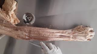 Muscles of extensor compartment of Forearm  Muscles of posterior compartment of forearm [upl. by Julieta]