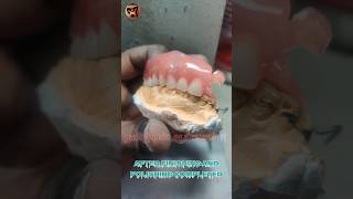 Upper Removable Partial Denture  URPD  Dental Prosthodontics Lab Work  Dental Doctor  dentallab [upl. by Etiragram831]