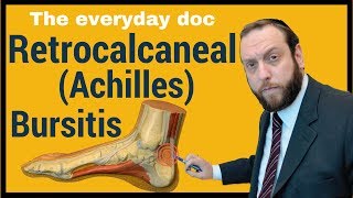 Retrocalcaneal bursitis or Achilles Bursitis [upl. by Merkley]