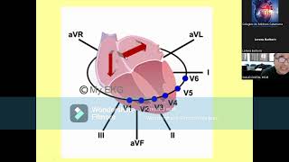 Video 2da Clase Curso  Taller Electrocardiografía [upl. by Naujahs330]