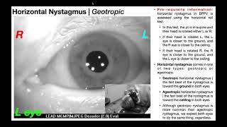 Nystagmus EXPLAINED 👀  Visualizing amp Interpretation [upl. by Starinsky]