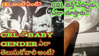 How to Gender Predict CRL LengthCRL MeansCRL Values తోGenderఎలాCalculator చేసుకోవాలిCRL cm to mm [upl. by Aihsia868]