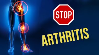 Exercises For Arthritis While Sitting Easy Effective [upl. by Eolcin]