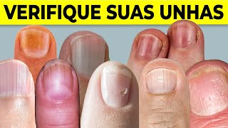 8 Coisas que suas UNHAS Podem Dizer Sobre sua Saúde [upl. by Adniled]