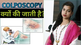 Colposcopyकॉल्पोस्कोपी क्या है  Colposcopy Test in Hindi [upl. by Dona554]