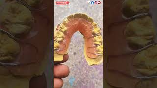 Ortho plate trending viralvideo hamidraza01 ideal2 dental lab Pune [upl. by Kirsten]