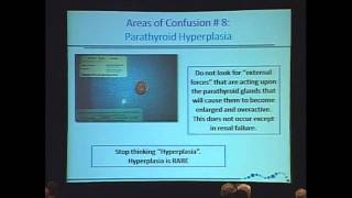 Parathyroid Hyperplasia is Rare Hyperparathyroidism Diagnosis and Treatment [upl. by Znerol]