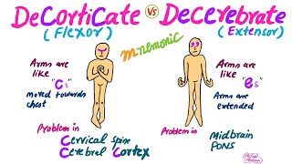 Decorticate Vs Decerebrate RigidityMnemonic for USMLE [upl. by Asyram145]