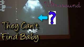 8 Weeks Pregnant Ultrasound  Cant Find Baby  Scared [upl. by Adnovad]