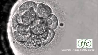 Human Embryo Growing from Fertilization to Day 6 Blastocyst [upl. by Ientruoc]