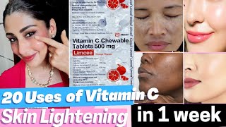 20 Benefits of Vitamin C for Skin  Limcee Vitamin C tablet for Skin remove Tan dark spots Melasma [upl. by Birdella347]