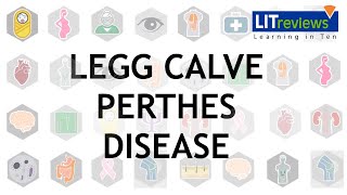 Legg Calve Perthes Disease [upl. by Ivonne226]