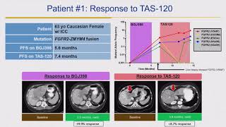 2018 Cholangiocarcinoma Foundation Annual Conference 11  Day 2  FGFR Inhibition [upl. by Eittocs273]