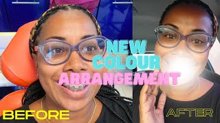 ORTHODONTIST VLOG NEW COLOUR ARRANGEMENT ADULT BRACES for VACATION TRAVEL and US ROAD TRIP [upl. by Berner297]