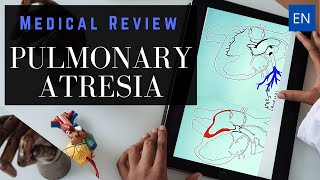 Pulmonary Atresia Anatomy and Pathophysiology [upl. by Yenrab]