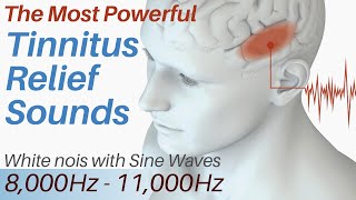 Tinnitus Relief Sounds  White Noise amp Sine Waves 8000Hz  11000Hz  Tinnitus Sound Therapy [upl. by Ffilc169]