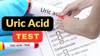 Uric acid test  Uric acid test kasy krty hai  What is Uric acid test  uricacid [upl. by Donahoe]