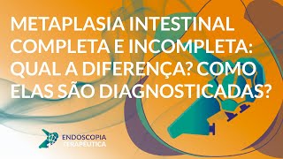 Metaplasia intestinal completa e incompleta qual a diferença Como elas são diagnosticadas [upl. by Sim]