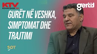 Gurët në veshka simptomat dhe trajtimi [upl. by Akcire]