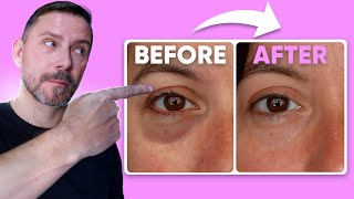 HOW TO MAKE EYE BAGS VANISH IN SECONDS FULL DEMO [upl. by Gerge151]