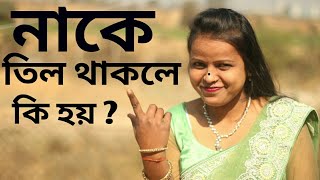 নাকে তিল থাকলে ভাগ্য কেমন হবে bangla astrology tips for our luck nake til thakle ki tar artho [upl. by Virgin345]