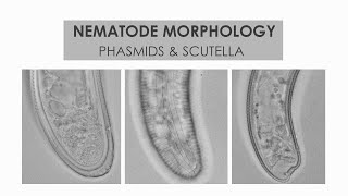 NEMATODE MORPHOLOGY PHASMIDS AND SCUTELLA [upl. by Namhar724]