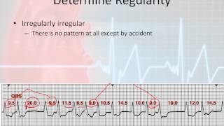 Basic Rhythm Interpretation parr 5  The Systematic Approach 3 [upl. by Chesney]