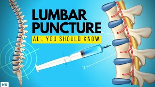 Lumbar Puncture Everything You Need to Know [upl. by Lawler]