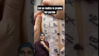 ¿Qué es la prueba del parche para la alergia [upl. by Tdnerb376]