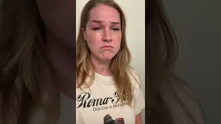 BAD eyelash extension infection  HELP eyelashes eyelashextensions [upl. by Eseryt]