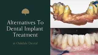 Alternatives to dental implant treatment [upl. by Estus]