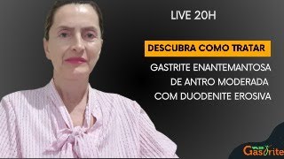 Descubra como tratar gastrite enantemantosa de antro moderada com duodenite erosiva [upl. by Tobie]