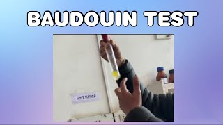 Baudouin test for Ghee [upl. by Fillander829]