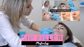 Natural Looking and Beautiful Lips  Dermal Filler Training Masterclass [upl. by Ymia445]