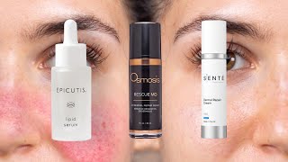 Easy 3Step Rosacea  Sensitive Skin Routine [upl. by Annaitat]