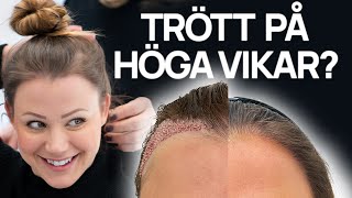 Trött på höga vikar Gör en hårtransplantation [upl. by Valorie]