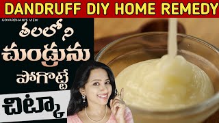 Dandruff Treatment at Home  Home remedies for Dandruff in telugu  Dandruff Removal at home [upl. by Wein]