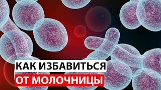 Как вылечить молочницу у женщин навсегда [upl. by Molini]