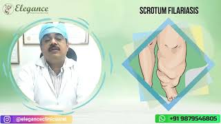 Scrotum Filariasis Elephant Foot Treatment Swollen Leg Giant Leg Treatment Surat Gujarat India [upl. by Faxon]