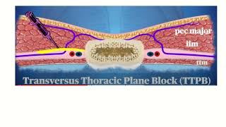 Anatomy of Intercostal Nerve Block A Comprehensive Guide [upl. by Clementina]