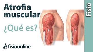 Atrofia muscular  Qué es y cómo sucede [upl. by Remot]