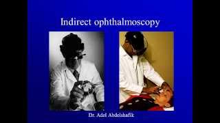 Optics course new Indirect Ophthalmoscopy [upl. by Assilym]